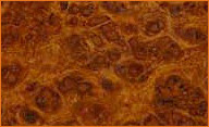 Amboyna Burl